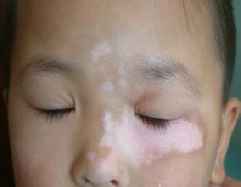 右手胳膊手术之后长白点是什么原因啊、