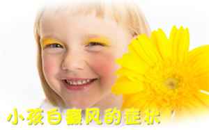 【白癜风常识】